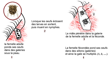 gale-infection-sante-intime