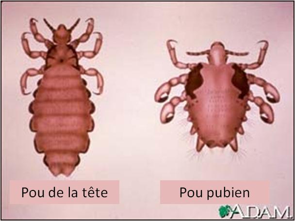 morpions-sante-intime morpions-sante-intime