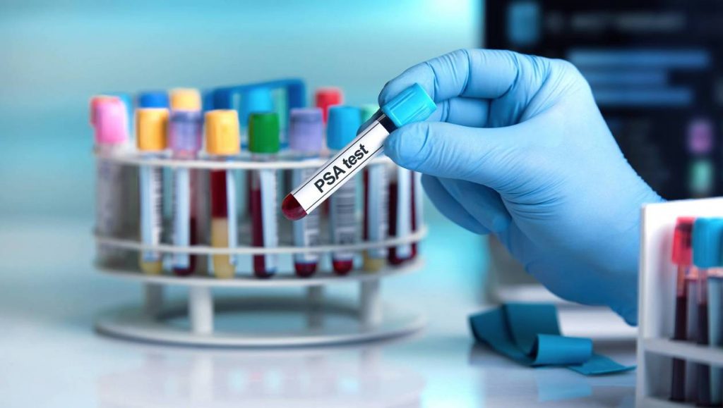 test-contre-cancer-sante-intime-6 test-contre-cancer-sante-intime-6