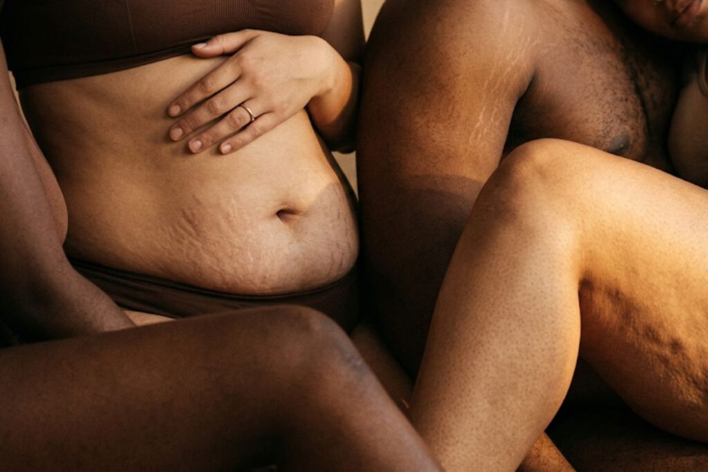 Le mouvement body positive : pourquoi il change les mentalités